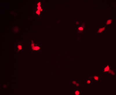 不同融合 非融合表达载体的构建及亚细胞定位