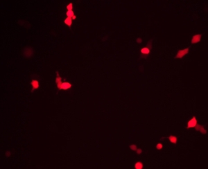 不同融合 非融合表达载体的构建及亚细胞定位